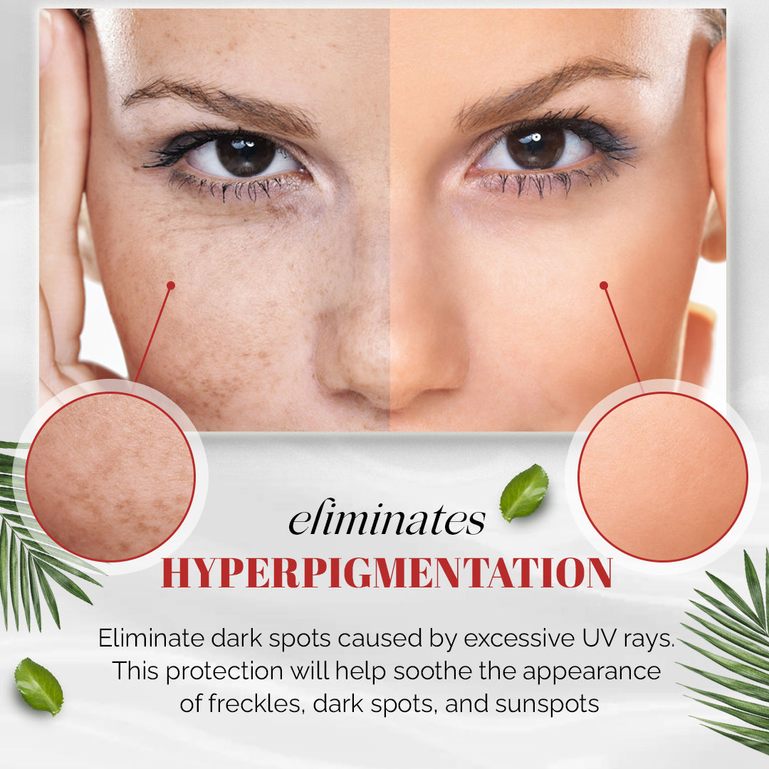 Effective Whitening Freckle Cream