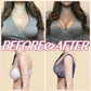 BeautyLift™  Lymphvity Detoxification and Shaping & Powerful Lifting Bra(Limited time discount Last 30 minutes)