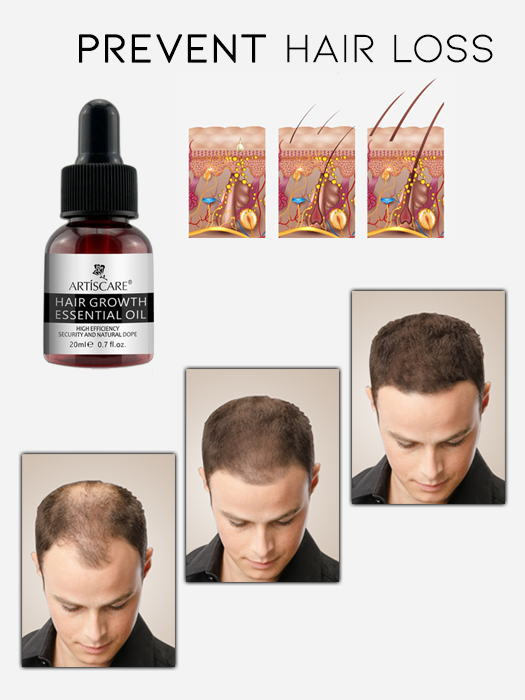 ArtisCare Hair Growth Essential Oil