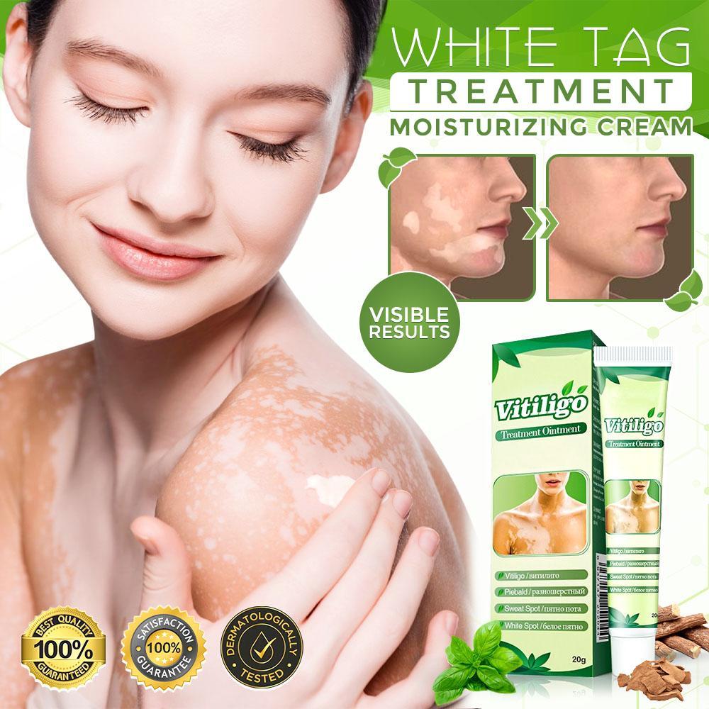 White Tag Treatment Moisturizing Cream