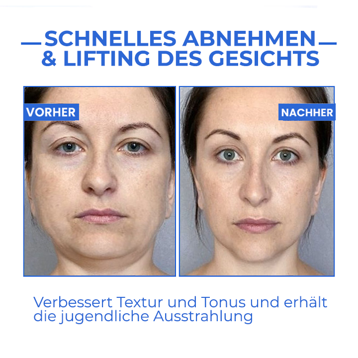 Youthfully™ Botox Gesichtsserum