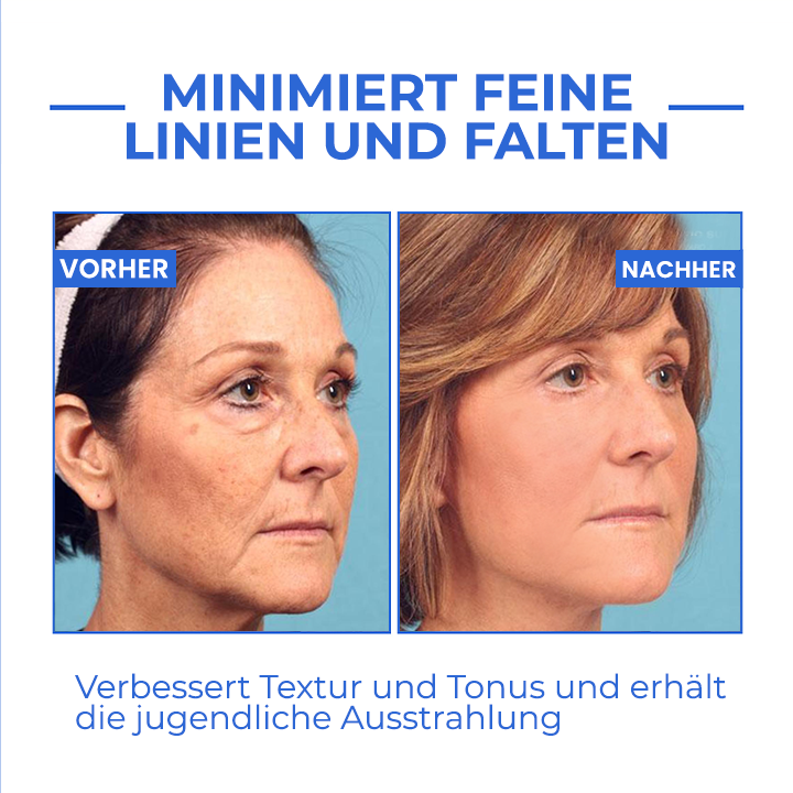 Youthfully™ Botox Gesichtsserum